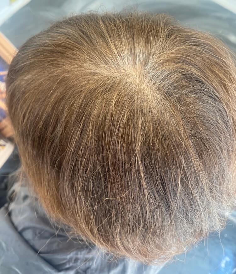 After