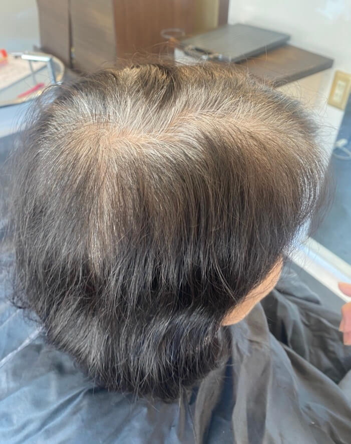 Before